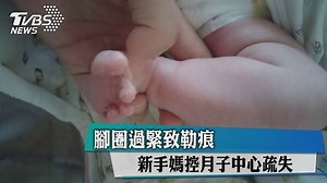 121K views · 1.4K reactions | 這個勒痕...........