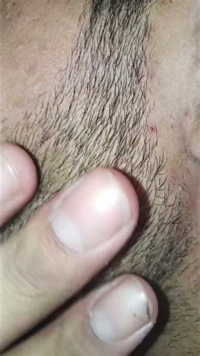 softness of beard looks#beard#soft care#style #pimple #best