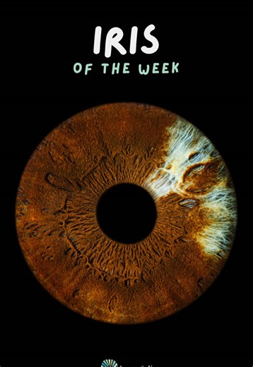 IRIS OF THE WEEK 👁️ This stunning iris features deep copper-brown tones with rich radial textures. What makes it truly special is the lighter section on the right, known as sectoral heterochromia, a natural variation where part of the iris has a different color due to uneven melanin distribution. A beautiful reminder that no two irises are ever the same. ✨ Iris model: @treatz4u #eyemazyamsterdam #irisphotography #amsterdamactivities