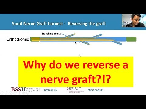 Why reverse a sural nerve graft?