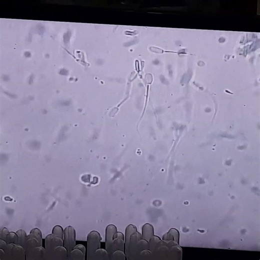 PEMERIKSAAN MIKROSKOPIS UNTUK MENGETAHUI VIABILITAS DARI SPERMATOZOA #sperm #lab
