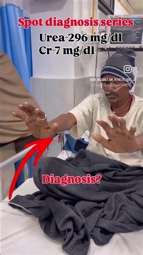 Spot diagnosis series#mbbs #doctor #ytshorts