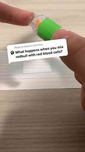 Red Bull’s Effect on Blood Cells Under the Microscope