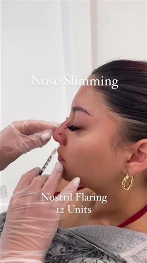 Nose Slimming Without Surgery at Zoh Aesthetic Clinic, Hyderbad