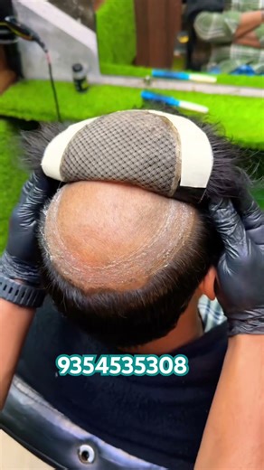 Hair patch glue adhesive sar vice #shorts #trending #hair