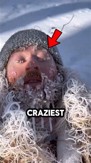 Snow Found Under the Microscope… This Is INSANE!😱