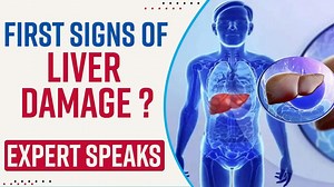 Explained: Symptoms, Early Signs And Treatment For A Damaged Liver, Expert Speaks - Watch