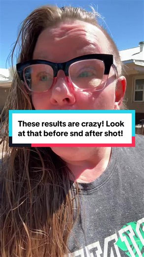 These toothpaste tablets by @Whitebite Pro have whitened my teeth so much in just a week. They taste great and don’t cause sensitivity. They get my teeth so clean and help with any teeth issues I have. #toothpastetablets #whiteningtoothpaste #nanohydroxyapatite #oralcare #whitebitepro