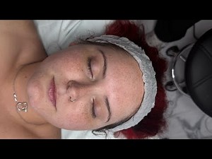 Microdermabrasion Facial Walkthrough | Full Step-by-Step Guide