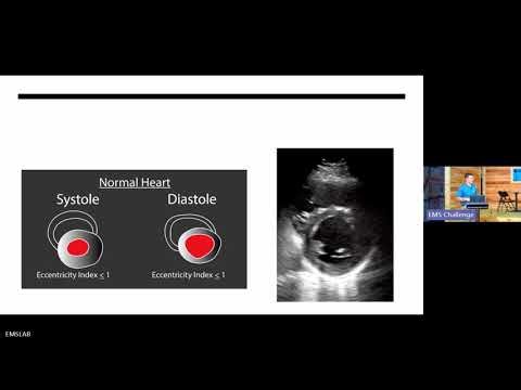 Non-Cardiac Chest Pain & Chest Trauma- Troy Fire Department
