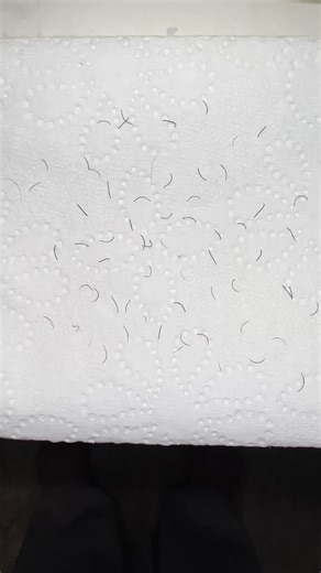 My Christmas gift to you 🎁, a new plucking video 🎄 #pluckwithme #pluckingchin #pluckingchinhairs #pluckingchinhair #plucking #hairremoval #tweezers #satisfyingplucking #pluckingtherapy #tweezertok #musthavetweezers #satisfying #oddlysatisfying #selfcare #pluckingasmr