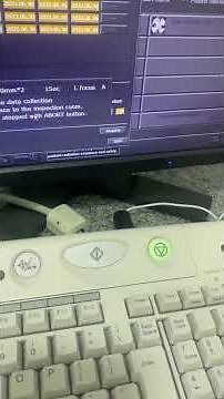 Toshiba CT Scanner Air Calibration Guide 📹🔧 It can help you to remove artifacts from your SCANNER