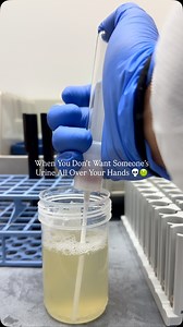 286K views · 11K reactions | You think we just pour the urine into these skinny tubes? Oh hell nah. This is a urine transfer device. It pulls urine directly from the cup into the tube without us having to pour and pray. No spills, no dirty, wet gloves! Alot cleaner and safer than pouring it out! Pretty nifty, eh? DM me “PASS” on IG to pass the ASCP Exam 離良 | Marilyn Claire | Facebook
