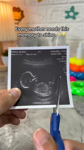 3.8K views · 8.1K reactions | Perfect gift for moms to be 凉﫠 #pregnant #pregnancy #ultrasound #mom | Memory Sphere | Facebook