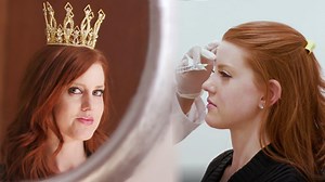 Women are getting surgery to achieve the Meghan "Markle Sparkle." ✨ | VICE Life