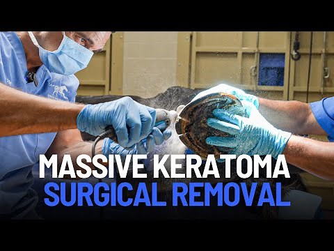 Keratoma Removal in Horse Hoof | Step-by-Step Equine Surgery Guide