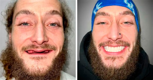 53 Dental Work That Made People Smile Without Hesitation And Shame