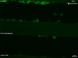 File:Rac1-mediated-signaling-plays-a-central-role-in-secretion-dependent-platelet-aggregation-in-human-1479-5876-8-128-S3.ogv - Wikimedia Commons