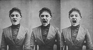 The History Of 'Hysteria' And How Science Can Be Sexist