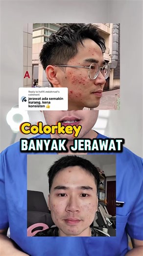 Colorkey Purifying Gel Cream with Green Tea for Acne