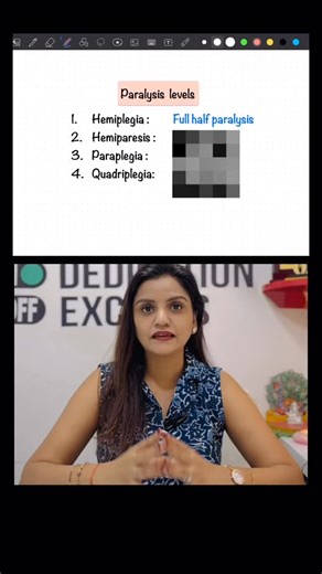 Dr. Neha Shukla Consultant Physiotherapist on Instagram: "Stages of paralysis simplified 🎯 Follow for more learning✅"