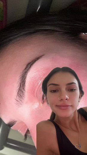 Effective Solutions for Eyelid Dermatitis and Eczema | Get Relief and Heal Naturally