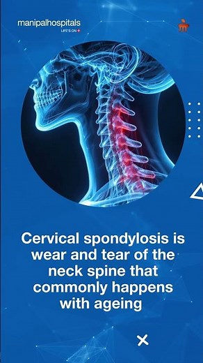 Cervical Spondylosis: Causes, Symptoms & Treatment | Manipal Hospitals Jaipur