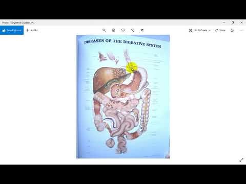 Q & A | Rối loạn Thần kinh Thực vật - Đau Dạ dày HP - Viêm phế quản