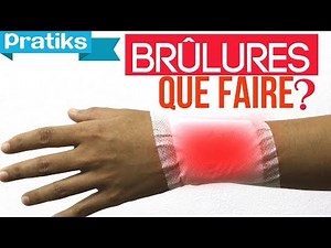 Que faire en cas de brûlure premiers secours