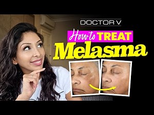 Doctor V - How To Treat Melasma | Skin Of Colour | Brown Or Black Skin