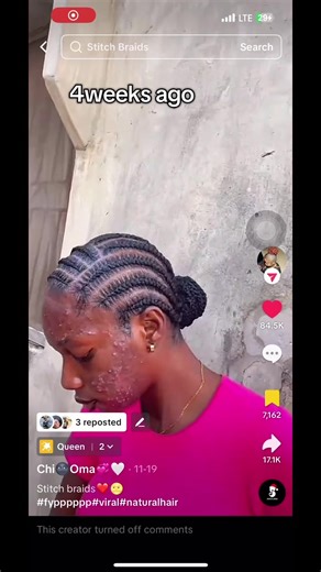 From 0 confidence - 100 confidence 😍 patronize @daisyhome_lagos (Esthetician) you won’t regret it 😩😩😩😩😩#acnejourney #acnetreatment #skincare #creatorsearchinsights2025