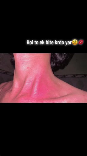 Love Bite: A Romantic Gesture Explained