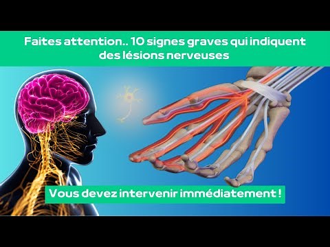 Pain, Tingling, Weakness… Watch Out for These Signs of Neuropathy!