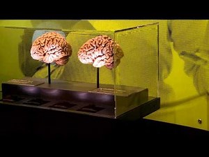 First Look at Brain: The Inside Story