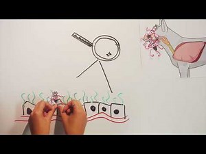 Bordetella bronchiseptica