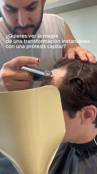 Prótesis Capilar: Transformación Instantánea y Segura