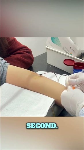 China’s Lightning Fast Flying Needle Technique