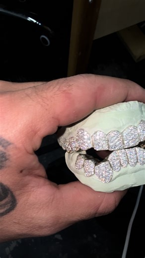 Brilliance for Crooked Teeth: A Smile Transformation