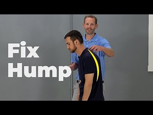 Dowager's Hump Exercises (AKA Hyperkyphosis)