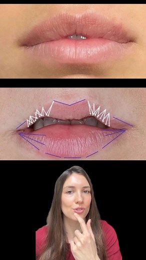 Understanding Lip Shapes: An In-Depth Look at Tubercles and Keyhole Lips