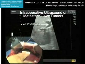 Ultrasound for Surgeons: The Basic Course—Clinical Example: Abdomen