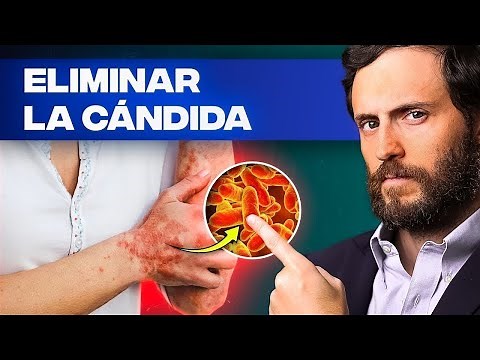 COMO ELIMINAR CANDIDA DE TU ORGANISMO NATURALMENTE