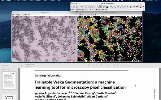 Fiji ImageJ 第23讲——用机器学习插件Trainable Weka Segmentation分析液滴的数目和形态