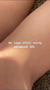 Smooth skin WITHOUT a razor or wax 勞⁠ ⁠ Just use advanced ipl 1x per week for 15-30 minutes and you're good to go⁠ ⁠ It only takes 8-12 uses to get permanently smooth skin!⁠ ⁠ Tell us, would you add Lumi to your shaving routine to get permanently smooth skin? ⁠ ⁠ Book now and get flat 50% off 懶 | Zeeman's | Facebook