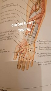 7.1K views · 84 reactions | A method of taping for carpal tunnel issues or a general wrist taping method. #carpaltunnelsyndrome #wristtaping #kinesiotaping | Bannockburn Chiropractic & Physical Therapy | Facebook