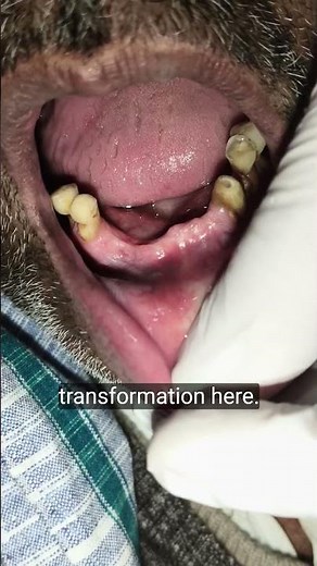 Fixed teeth bridge - fixed dental replacement #dentist #teeth #fixedteeth