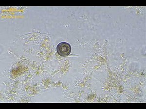 4K活性汚泥の微生物 アルセラ（Arcella）の仮足移動