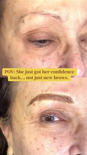This is why I love what I do. It’s never just about adding hair strokes it’s about restoring what was lost and bringing back that effortless beauty. Fuller, natural brows can lift your entire face, soften your features, and make you feel put together without even trying. But the best part? That moment when she looks in the mirror and feels like herself again 🤍 . #microblading #browtransformation #beforeandafter #glowup #confidenceboost