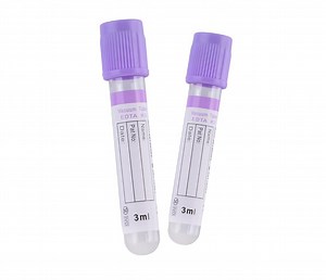 [Hot Item] EDTA Tube, Vacuum Tubes EDTA Tube EDTA. K3 /K2 Vacuum Blood Collection Tube