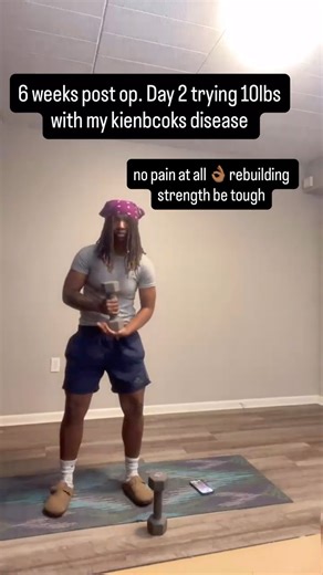 6 Weeks Post Op Core Decompression Radial Surgery , restrictions lifted! #progress #kienbocksdisease